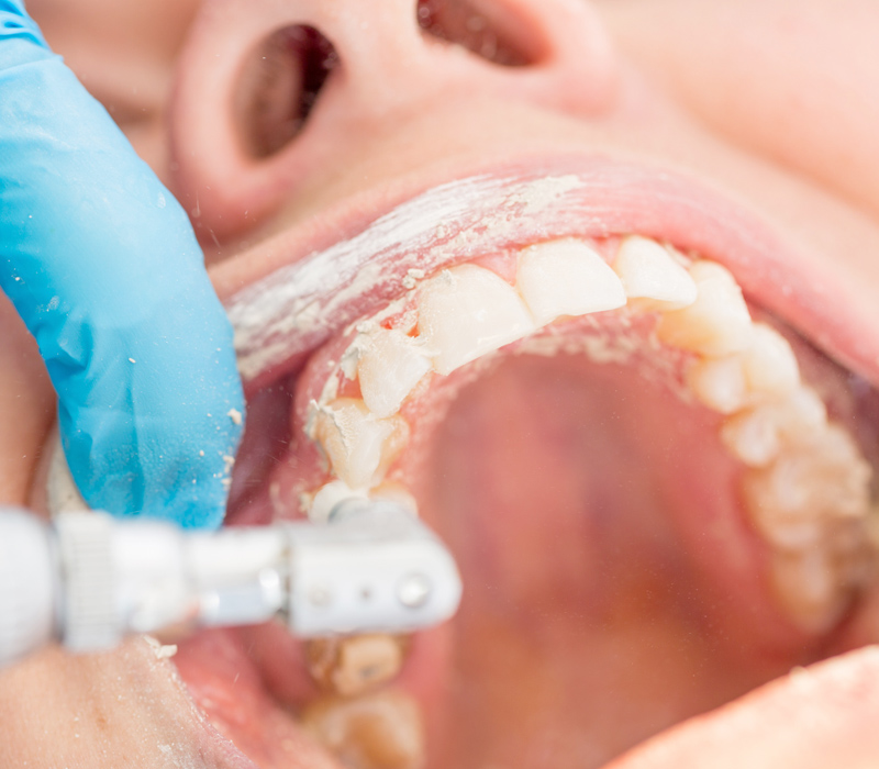 https://newyorkgalaxy.com/wp-content/uploads/2025/09/Sky-Dental-Care-in-Forest-Hills-NY-Dental-Cleaning-Service.jpg